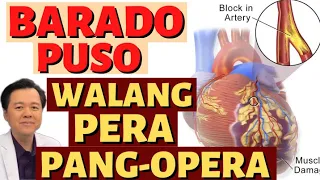 Barado Puso, Walang Pera Pang-Opera: Gawin Ito - By Doc Willie Ong (Internist and Cardiologist)#1486