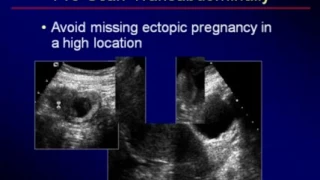 Pitfalls in Transvaginal Sonography
