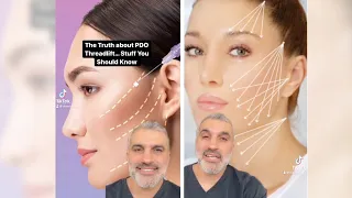 The TRUTH About PDO Threadlift - are they worth it?