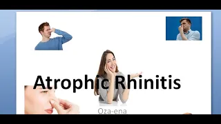 ENT Atrophic Rhinitis Ozaena Merciful anosmia Klebsiella Kemicetine Oestradiol young operation KI