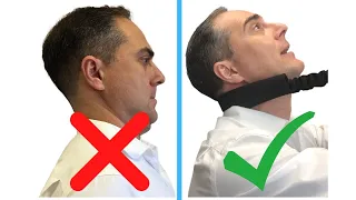 NEW & EASY Exercises to SAFELY Improve Military Neck and Cervical Kyphosis | Dr. Walter Salubro