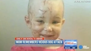 Mom bites off dog's ear as it attacks her daughter