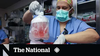 First-ever pig-to-human kidney transplant