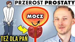 10 metod na przerost prostaty! Prostata: objawy rozrostu | Dr Bartek Kulczyński