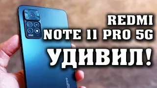 Xiaomi Redmi note 11 pro 5G Полный честный обзор. Redmi note 11 pro обзор. Какой смартфон купить?