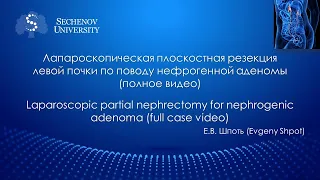 Лапароскопическая плоскостная резекция левой почки по поводу нефрогенной аденомы