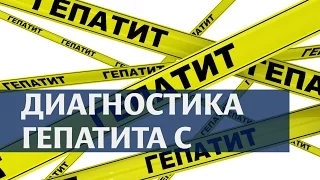 Диагностика гепатита С. Диагностика вирусного гепатита С в Клиническом госпитале на Яузе