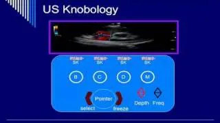 Doppler Instrumentation and Color Doppler - Segment #2