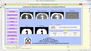 Lung Cancer Detection and Classification Using Neural Network Matlab Project code