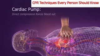 Life-Saving CPR Techniques Every Person Should Know