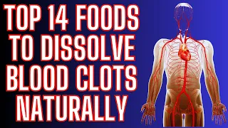 TOP 14 FOODS TO DISSOLVE BLOOD CLOTS | NATURAL BLOOD THINNERS
