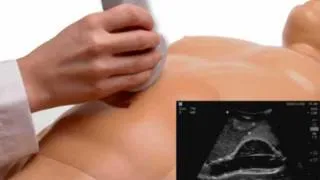 Abdominal Aortic Aneurysm (AAA) Ultrasound Model