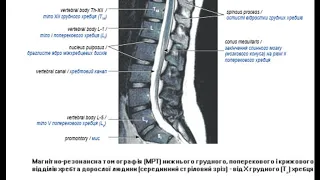 74.   Хребтовий стовп у рентгенівському зображенні - AnatomUa_AUDIO