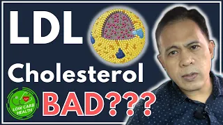 008: Is High LDL Cholesterol BAD for LCHF/KETO DIET?