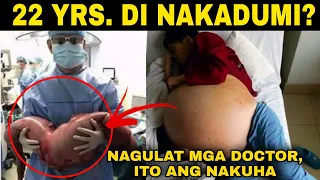 Ang lalaking HINDI NAGDUDUMI, Paano siya nabuhay? | True Story