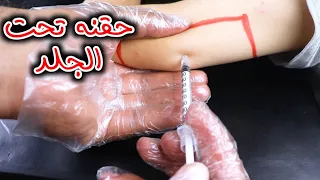 الطريقه الصحيحه لأعطاء حقنه الانسولين والكليكسان تحت الجلد_How to give a subcutaneous injection