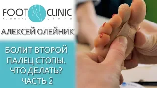 Молоткообразная деформация  2-го пальца. Часть 2.