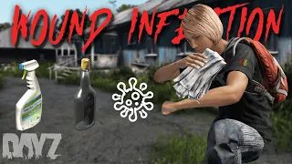 How to Cure Wound Infections in DayZ