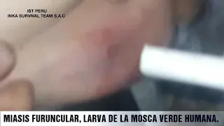 SUPERVIVENCIA/ LARVA MIASIS FURUNCULAR