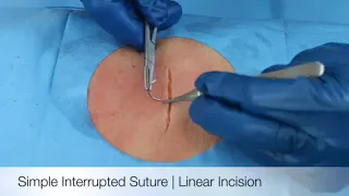 Simple Interrupted Suture | Linear Incision