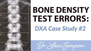 Bone Density Test Errors: DXA Case Study #2