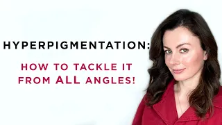 Hyperpigmentation: How To Tackle It From ALL Angles! | Dr Sam Bunting