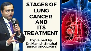 Stages of Lung Cancer & It's Treatment | Explained by Dr Manish Singhal (Sr. Oncologist)