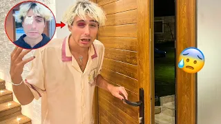 ANTO COLPISCE LA PORTA CON L’OCCHIO! SI È GONFIATO!! 🥺🚪*adesso è bendato*