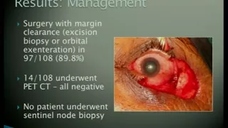 AIOC2018 - Free Paper - Ocular pathology