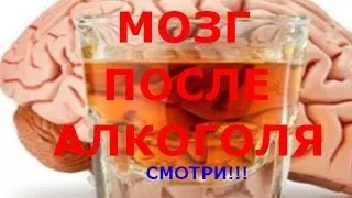 Мозг человека после употребления алкоголя.Смотри!!!