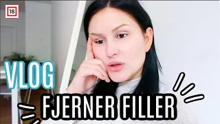 Vlog | Fjerner filler | Helene Heméra