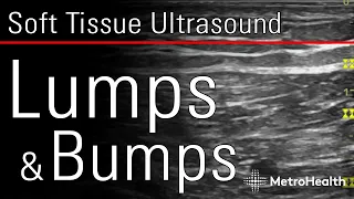 Soft Tissue Ultrasound: Lumps & Bumps