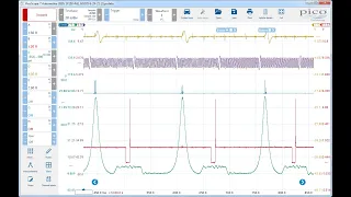 PX 35 en Picoscope Tutorial  de importación modificación y uso