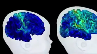 Emotions : que se passe t il dans le cerveau