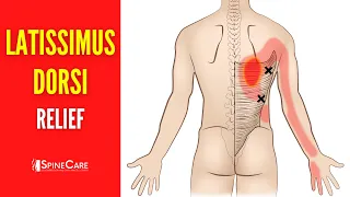 How to Fix Latissimus Dorsi Muscle Pain FOR GOOD