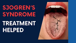 Sjogren's Syndrome Treatment HELPED by Dr Suh