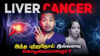 இந்த அறிகுறிகள் உங்களுக்கு இருக்கா? | Liver Cancer | கல்லீரல் புற்றுநோய் | Mr.GK