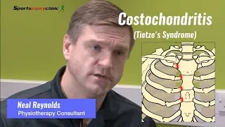 Costochondritis (Tietze's Syndrome) Explained