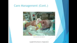 High Risk Neonatal Quiz