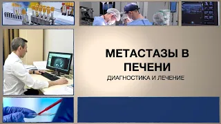 Метастазы в печени: диагностика и лечение.