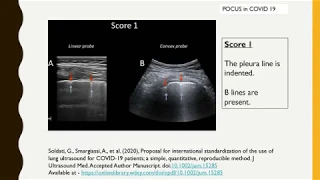 FOCUS POINT OF CARE ULTRASOUND IN COVID 19