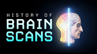 Brain Scan History - How did it all begin?