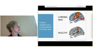 Dr. Redmond - Current Concepts in Chronic Pain Management