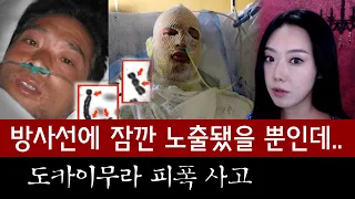 방사선에 잠깐 노출된 일본 직원의 최후 (도카이무라 피폭사고) | 토요미스테리