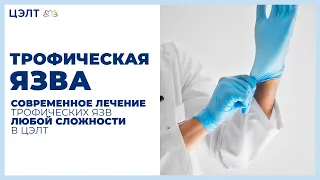 Трофическая язва. 💉 Современное лечение трофических язв любой сложности в ЦЭЛТ!