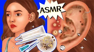 ASMR animationremoval of acne blackheads and sebaceous cysts for girls listening to music
