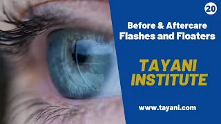 Flashes and Floaters / Optometry Education | Tayani Institute