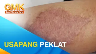 SCARS: Types and Treatments | Usapang Pangkalusugan