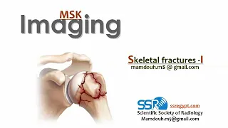 Skeletal fractures (part 1) ..Prof.mamdouh Mahfouz (2019 edition)