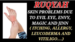 POWERFUL RUQYAH TO CURE ALL SKIN PROBLEMS DUE TO EVIL EYE,MAGIC & JINN ( ITCHING,ALLERGY, LEUCODERMA